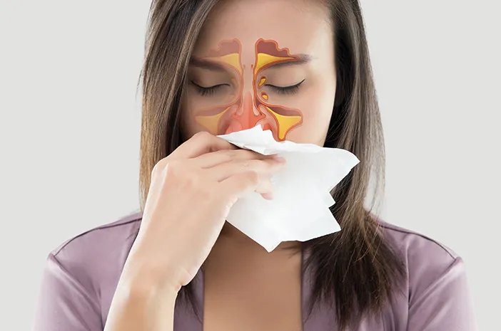 Sinusitis