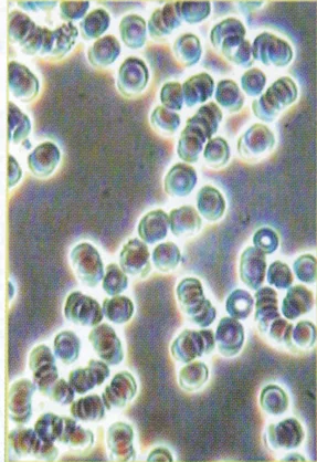 Sel Darah Merah Rantai Pendek