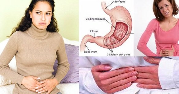 Penyebab Asam Lambung Naik dan Gejala “GERD”