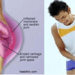 3 Faktor Resiko Tidak Dapat Dimodifikasi karena Rematik