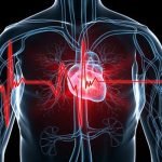 Cara Mudah Atasi Takikardia Tanpa Harus Operasi