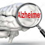 Pengertian, Pencegahan dan Penyebab Alzheimer