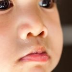 10 Gejala klinis Sinusitis beserta pengertiannya