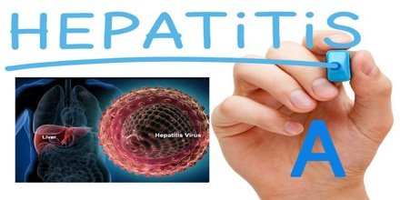 Hepatitis Virus Akut atau Virus Corona ?