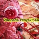 Penyebab kanker wajib anda ketahui !!!