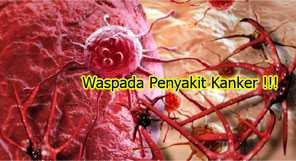 Penyebab kanker wajib anda ketahui !!!