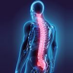 Penyakit Autoimun atau Multiple Sclerosis, apa itu?