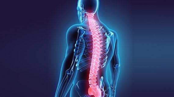 Penyakit Autoimun atau Multiple Sclerosis, apa itu?