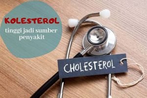 3 Cara Mudah Cegah Hiperkolesterol Tanpa Obat Kimia