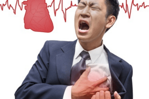 Cara mencegah serangan jantung