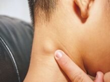 Cara Mudah Atasi Kelenjar Getah Bening Tanpa Operasi