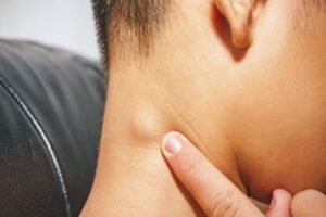 Cara Mudah Atasi Kelenjar Getah Bening Tanpa Operasi