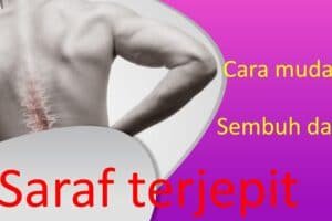Cara Mudah Sembuh dari Saraf Terjepit Tanpa Operasi