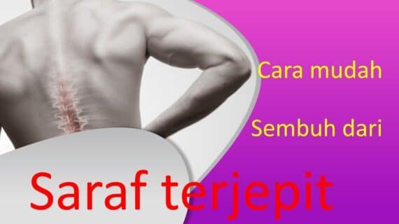 Cara Mudah Sembuh dari Saraf Terjepit Tanpa Operasi