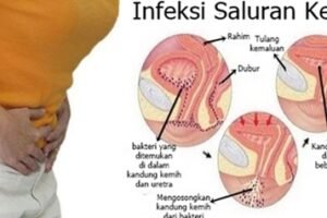 Infeksi Saluran Kemih, Ketahui Lebih Dini Gejalanya