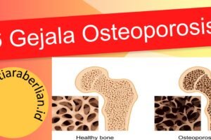 6 Gejala Osteoporosis Yang ke-5 Perlu Waspada