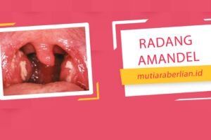 Cara Mudah Sembuhkan Radang Amandel Tanpa Resiko