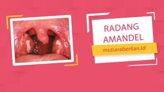 Cara Mudah Sembuhkan Radang Amandel Tanpa Resiko