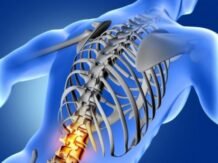 Terapi Agarillus Series Pada Penyakit Osteoporosis