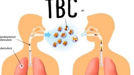 Atasi TBC dengan Produk Agarillus