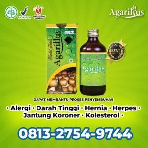 Obat Kolesterol Agarillus, WA 0813-2754-9744